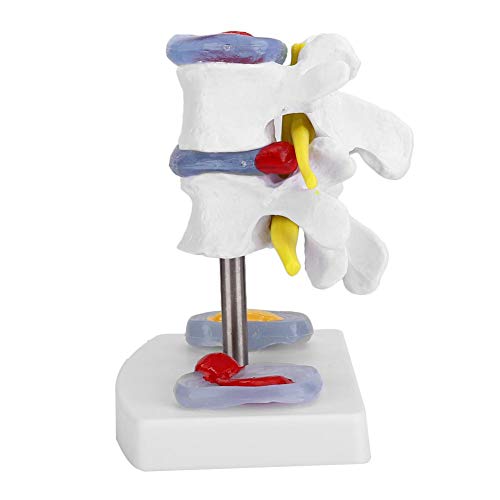 Lumbar model Anatomische lumbale hernia Demonstratie model Menselijke wervelkolom School Supplies