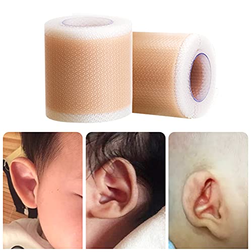 Siliconen pasgeborenen Baby oor esthetische correcties, pasgeboren oor esthetische Corrector correctie Patch Kinderen peuter Uitstekende oor Patch Sticker ademende oor Patches, 4 x