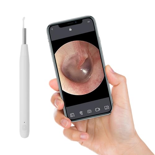 Earwax remover, in-ear camera oscope met indicatie licht, draadloze wifi Smart Visual oorlel, veilig en gemakkelijk te verwijderen oorwas, hoge resolutie oorlepel 1 miljoen pixels 4