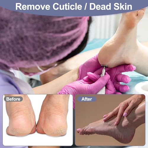 Sandpaper schijven met metalen nagel bit,25mm vervangbare Pedicure Sanding schijf Sandpaper Schijven bit voor dode huid Callus Verwijdering elektrische voet bestand gereedschap (#80grit)