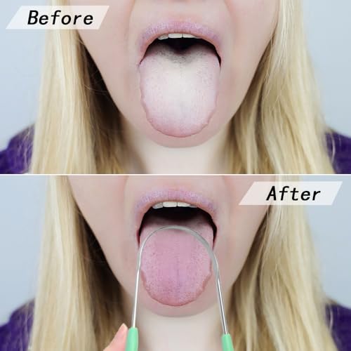 4 stuks tongschraper, metalen tongreiniger roestvrij staal tongreiniger auteurschap hervrijbare tongschraper mondverzorging tongschrapers tongreiniger voor volwassenen, kinderen, mannen 5