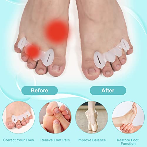2 Paar verstelbare Toe Spacers, Siliconen Toe Spacers Toe Pullers Toe Spacer voor Hammer Toes Scheiders voor Vrouwen Mannen (Maat M) 5