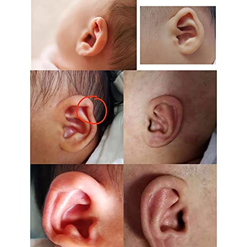Siliconen pasgeborenen Baby oor esthetische correcties, pasgeboren oor esthetische Corrector correctie Patch Kinderen peuter Uitstekende oor Patch Sticker ademende oor Patches, 4 x 3