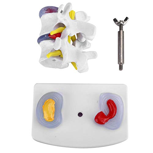 Lumbar model Anatomische lumbale hernia Demonstratie model Menselijke wervelkolom School Supplies 3