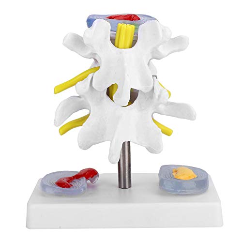 Lumbar model Anatomische lumbale hernia Demonstratie model Menselijke wervelkolom School Supplies