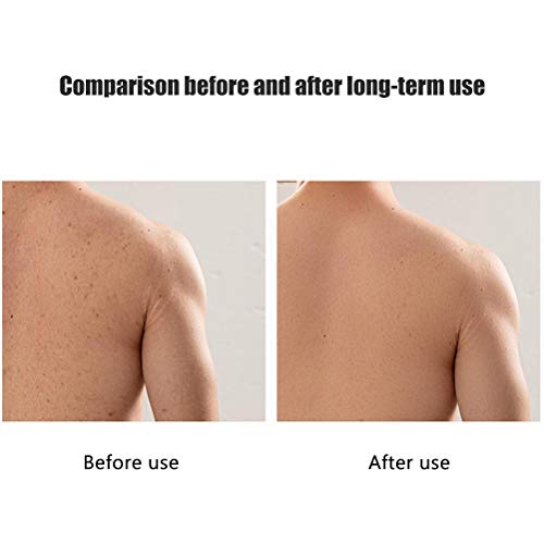 Exfoliating Back Scrubber voor douche, Heren Vrouwen Exfoliating Body Scrub Washandje Terug Washandje Terug Scrubber Handdoek voor douche (Licht Blauw) 5