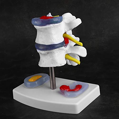 Lumbar model Anatomische lumbale hernia Demonstratie model Menselijke wervelkolom School Supplies 4
