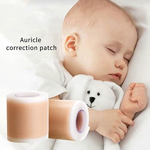 Siliconen pasgeborenen Baby oor esthetische correcties, pasgeboren oor esthetische Corrector correctie Patch Kinderen peuter Uitstekende oor Patch Sticker ademende oor Patches, 4 x 5