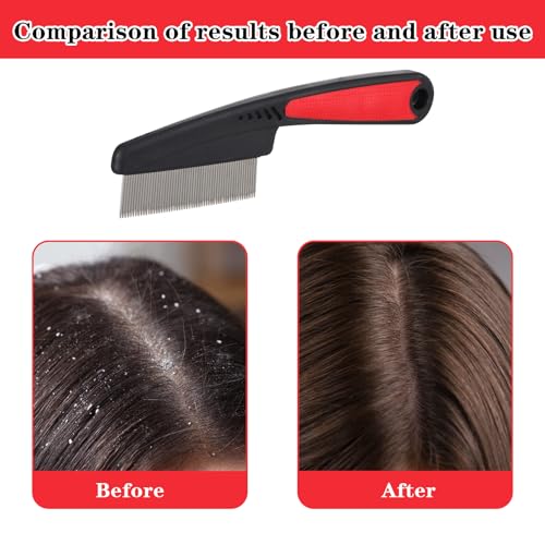 Verpakking van 2 Honden en Kat Comb, Flea en Dandruff, Lange Bristles, Roestvrij stalen borstel met brede en fijne tanden Grooming Tools 3