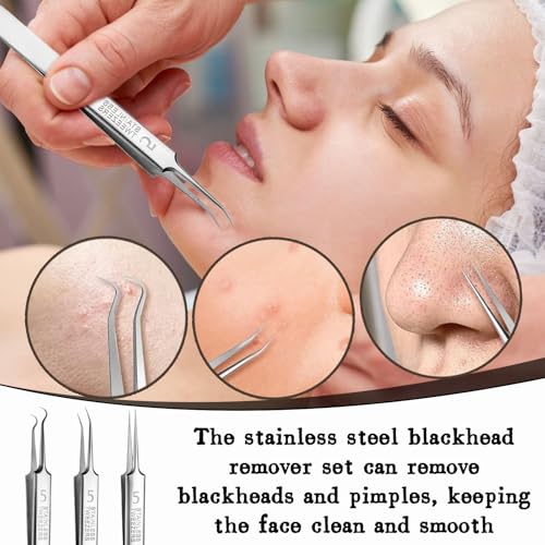 Blackhead Tweezers, 3 stuks, Roestvrij staal Professional Face Remover, Splint Tweezers, Pointed with Box, Pimple Expression Tools, Zilver 5