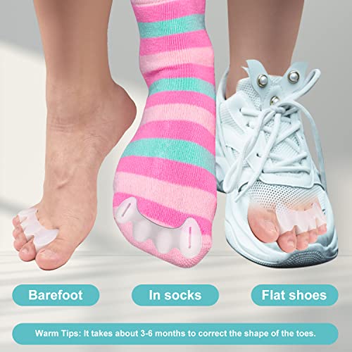 2 Paar verstelbare Toe Spacers, Siliconen Toe Spacers Toe Pullers Toe Spacer voor Hammer Toes Scheiders voor Vrouwen Mannen (Maat M) 4