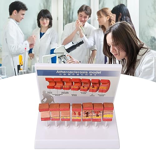 7PCS ArteryModel Schepen voor Medisch Onderwijs en Demonstratie, Onderwijs Tool met Verschillende Kleuren